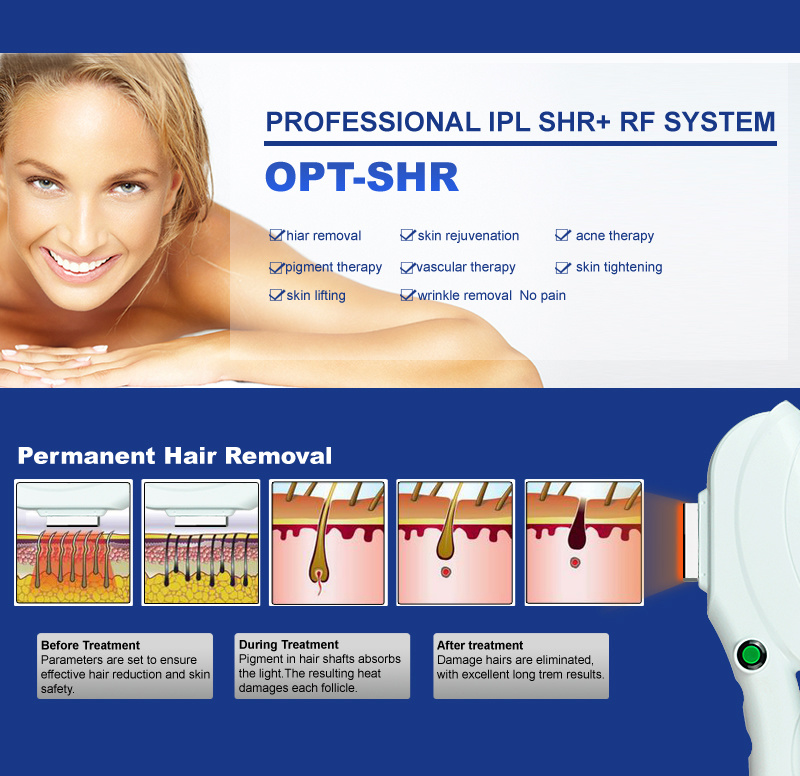 Shr Opt Fast Hair Removal IPL Machine with RF Skin Rejuvenation