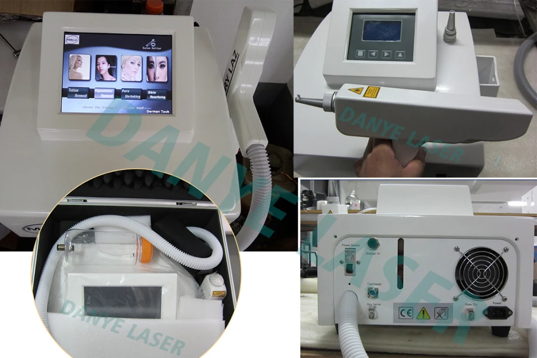 Cheap Handheld 1064-Nm ND YAG Laser Tattoo Removal Laser Machine Price in India