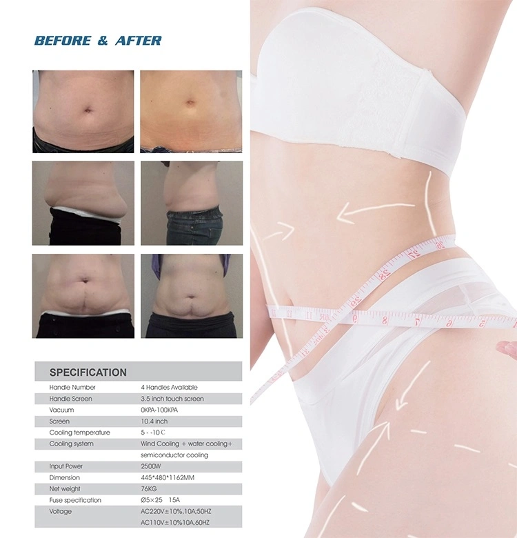 Cryolipolysis Freeze Fat Slimming Machine 4 Handles for Fat Freeze Working at The Same Time