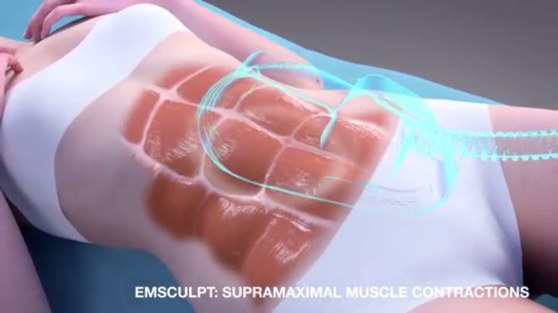 New Em-Sculpting EMS Body Sculpt Fat Removal Muscle Building Machine