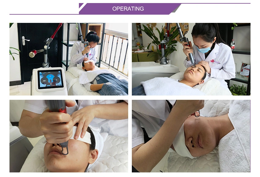 Sunbum Age Spot Chloasma Skin Remove ND YAG Laser Device