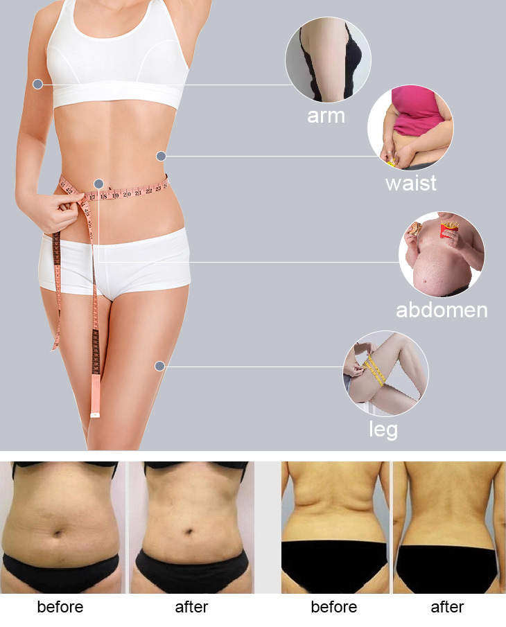 Body Shaping Liposonix Machine Slimming Weight Loss Beauty Slimming Machine