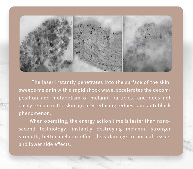 Wholesale Pico Laser Machine Tattoo Removal 2020 for Freckle Removal