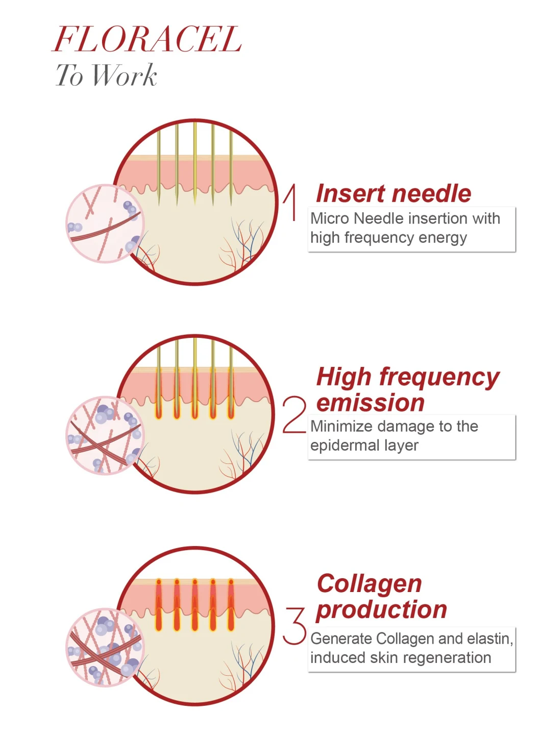 Fractional Micro Needle RF & Thermal RF Functional Beauty Medical Device