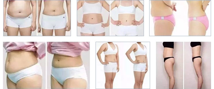 Hot Sale Cryolipolysis 3 in 1 Slimming Machine Cavitation RF Salon Home Use Beauty Machine