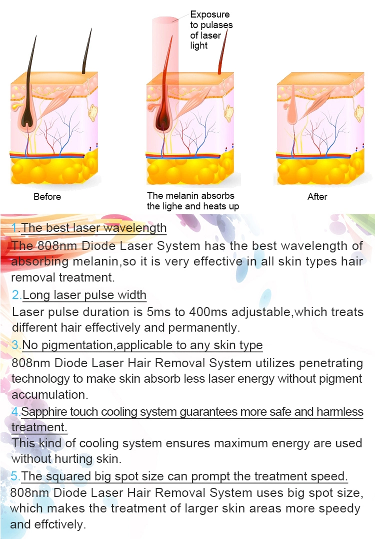 3 Wavelength Diode Laser Hair Removal Diode Laser Hair Removal Apparatus with High Power Good Effective