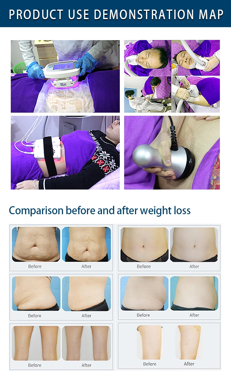 5 in 1 Functions Body Cool Shape Slimming System for Criolipolisis Machine Freeze Fat Lipofreeze Slimming