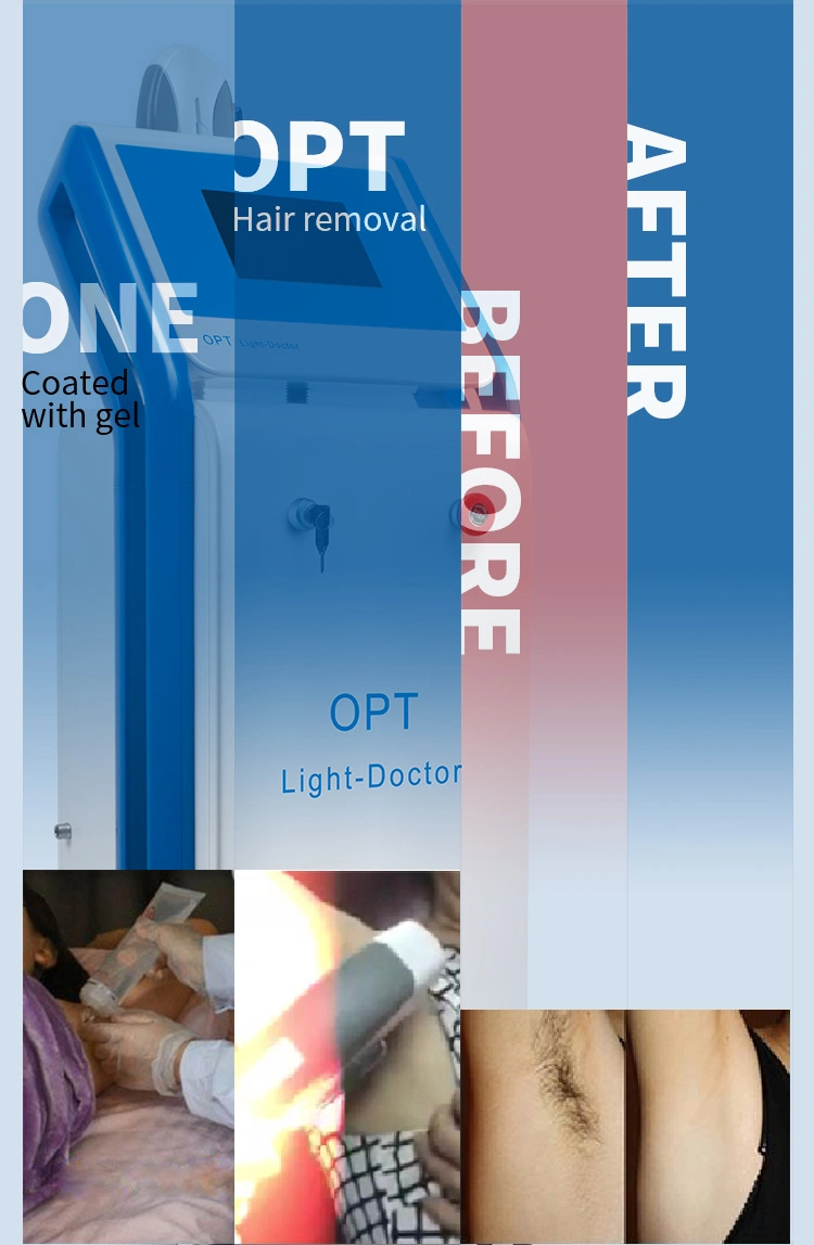 2019 New Design E-Light Shr Opt/IPL Hair Removal Skin Care Beauty Equipment