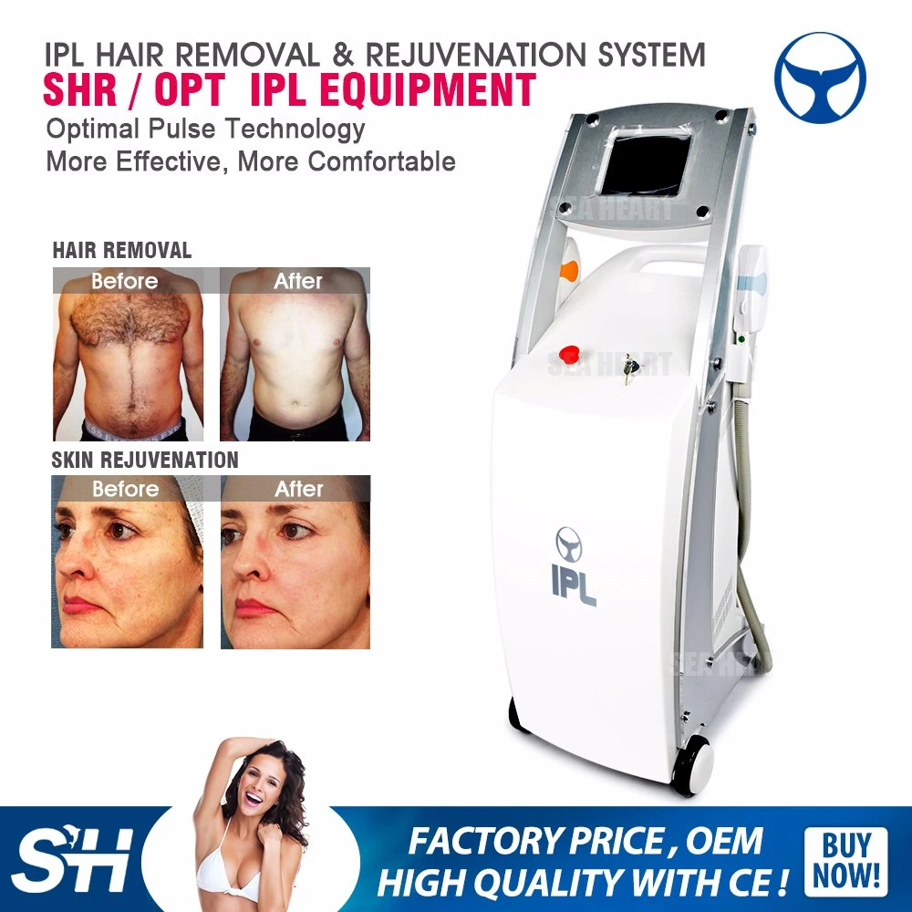 Popular Model Shr Opt IPL Hair Removal Machine with RF