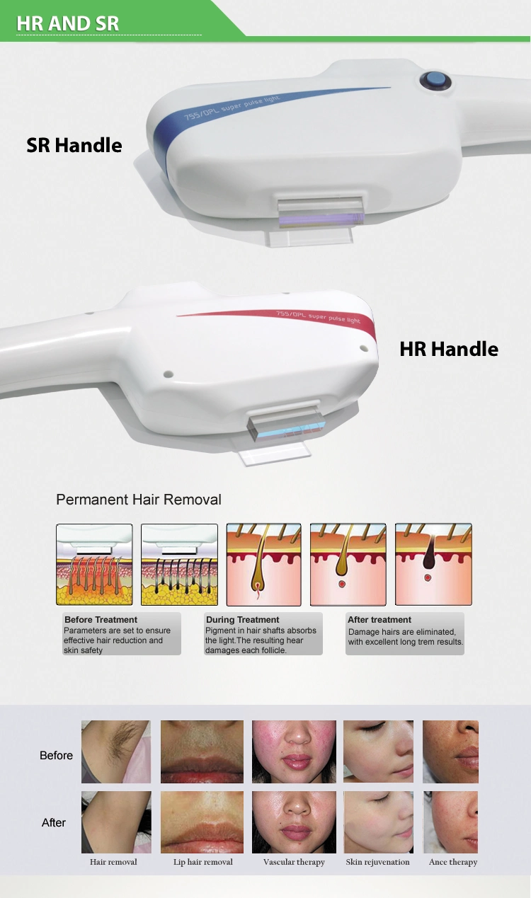 The Latest Portable Double Handle Dpl IPL Hair Removal Machine
