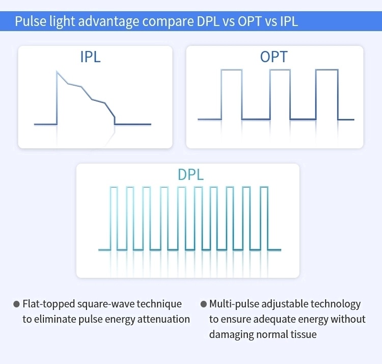 Portable Dpl IPL Elight Opt Shr Fast Permanent Hair Removal Machine