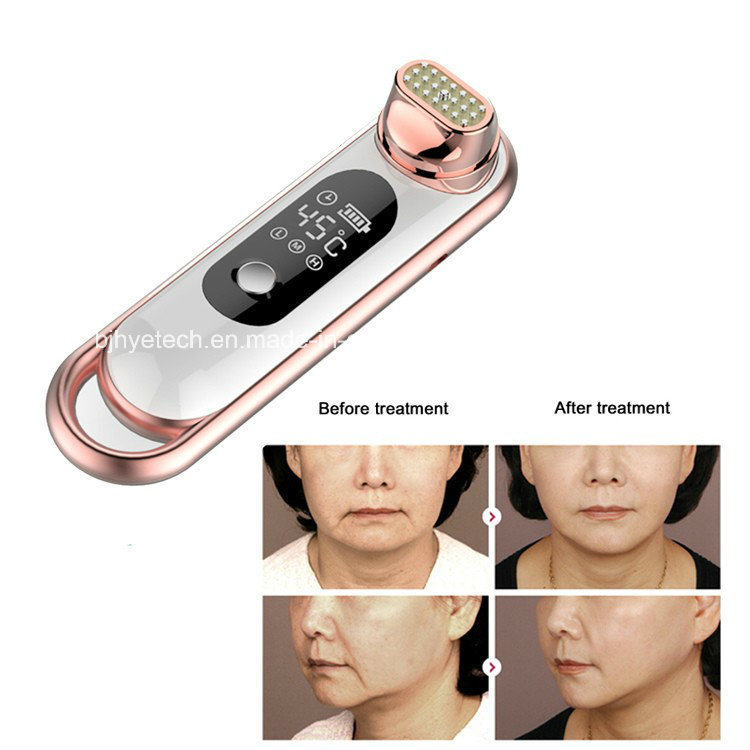 New Personal Electrical Portable RF Radio Frequency Facial Care Machine for Face