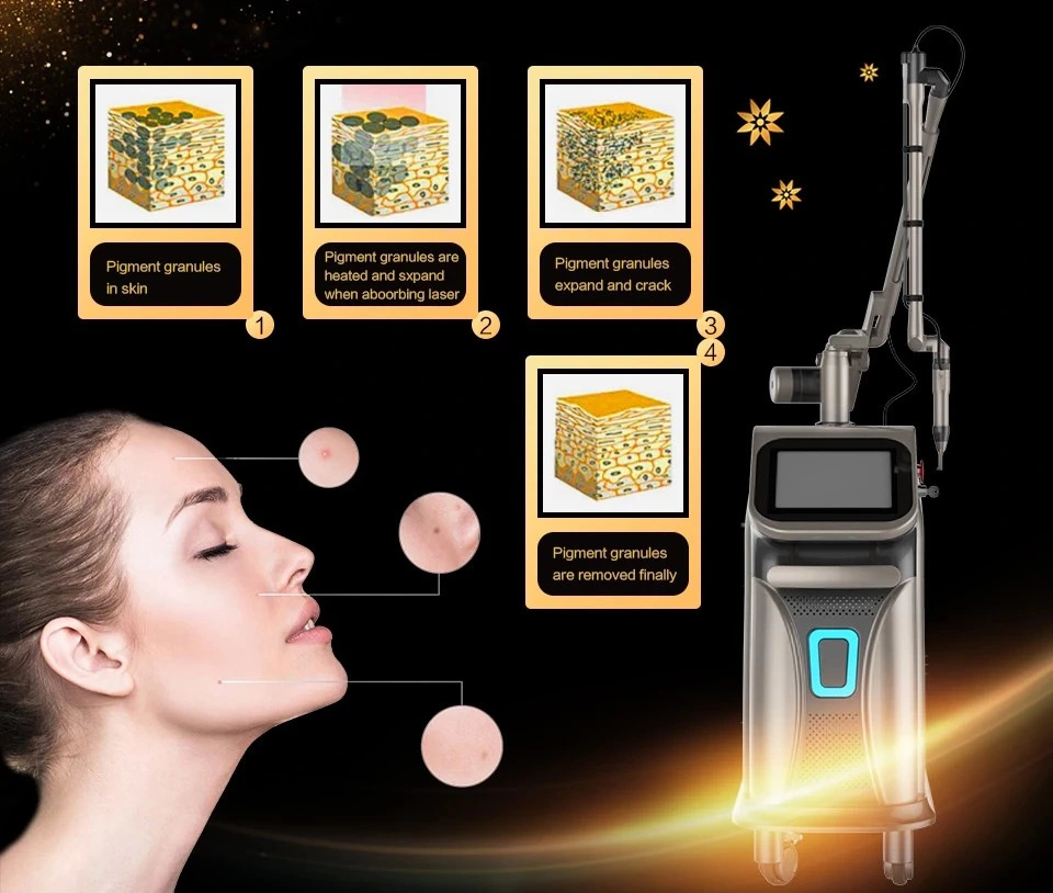 1064 & 532 Nm ND YAG Laser Tattoo Removal Machine Factory Price Laser Tattoo Removal Machine