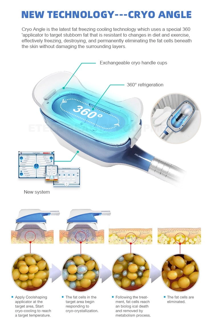Effective Lipo Laser Cryo Cryolipolysis 360 System Criolipolisis Fat Freeze Slimming Machine