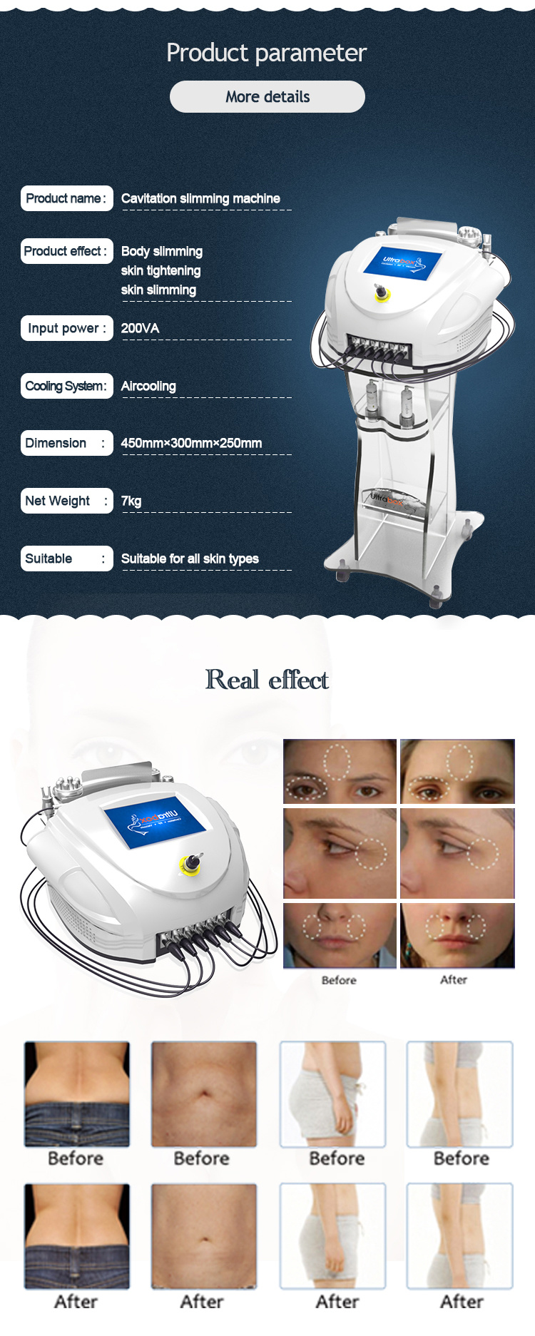 New Products Portable Home Ultrasound Weight Loss Slimming System Cavitation Vacuum RF Machine