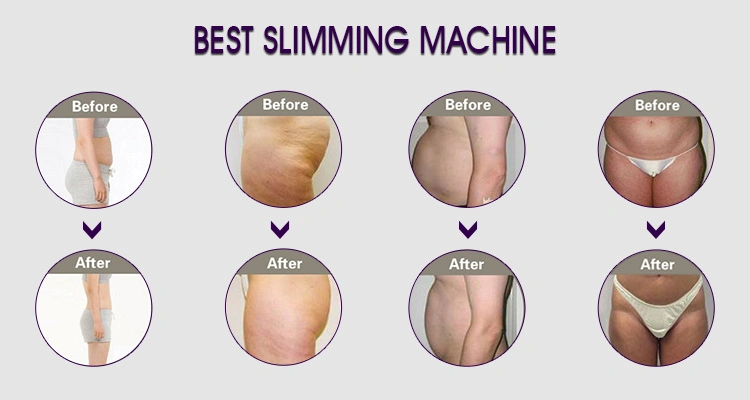 Freezing Fat Reduction Beauty Machine Cryotherapy RF Cavitation Diode Laser Slimming Use System