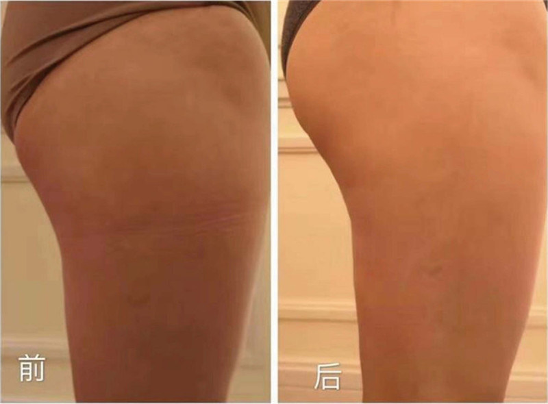 Porfessional Hiemt Electromagnetic Muscle Toning Machine for Body Sculpting