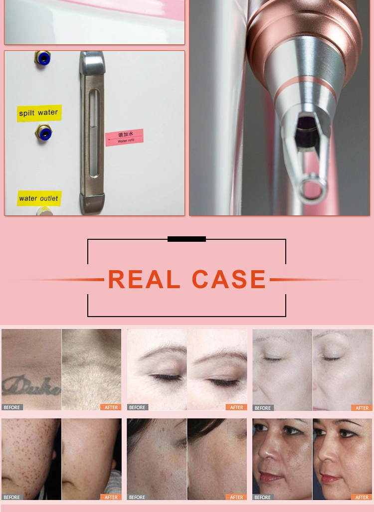 3 in 1 Picosecond Laser & Shr Elight IPL & RF Hair Removal Beauty Equipment for Clinic