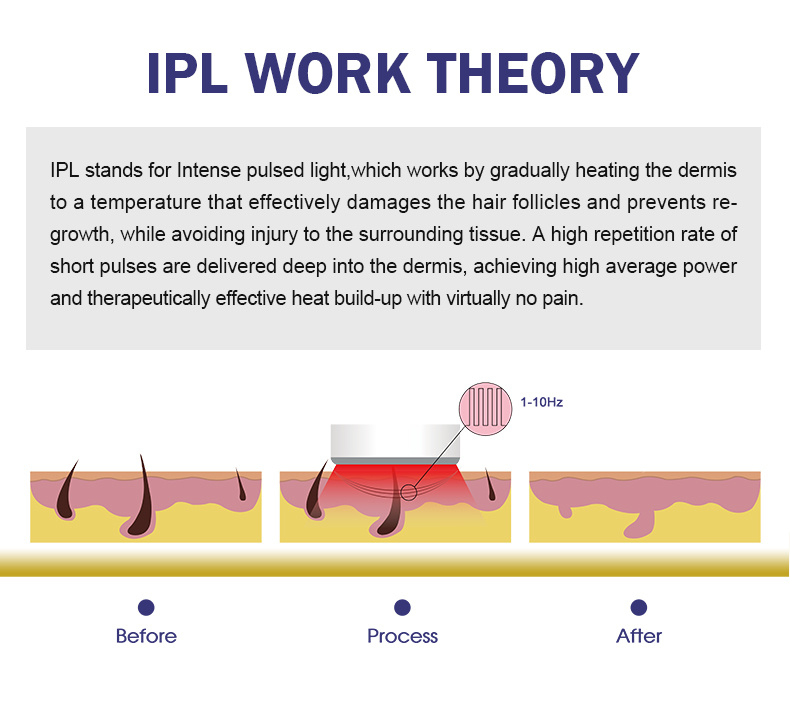 Multifunction IPL Elight Shr Opt Face Lift Hair Removal Instrument