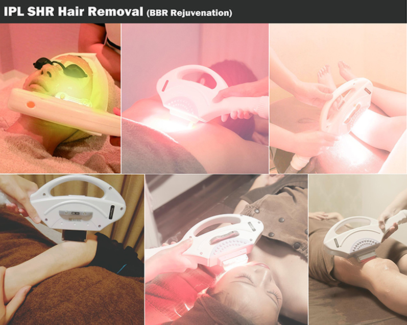 Opt IPL Shr Beauty Equipment for Hair Removal Skin Rejuvenation