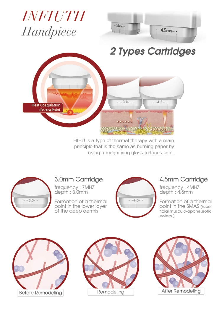 High Intensity Focused Ultrasound Antiaging Hifu Salon Equipment