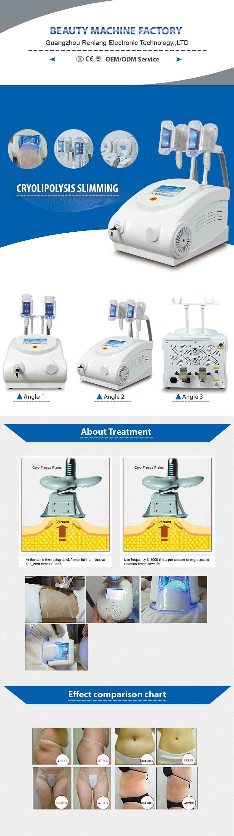 Good Effective Vacuum Slimming Anti Cellulite Machine Body Vacuum Therapy Slimming Machine
