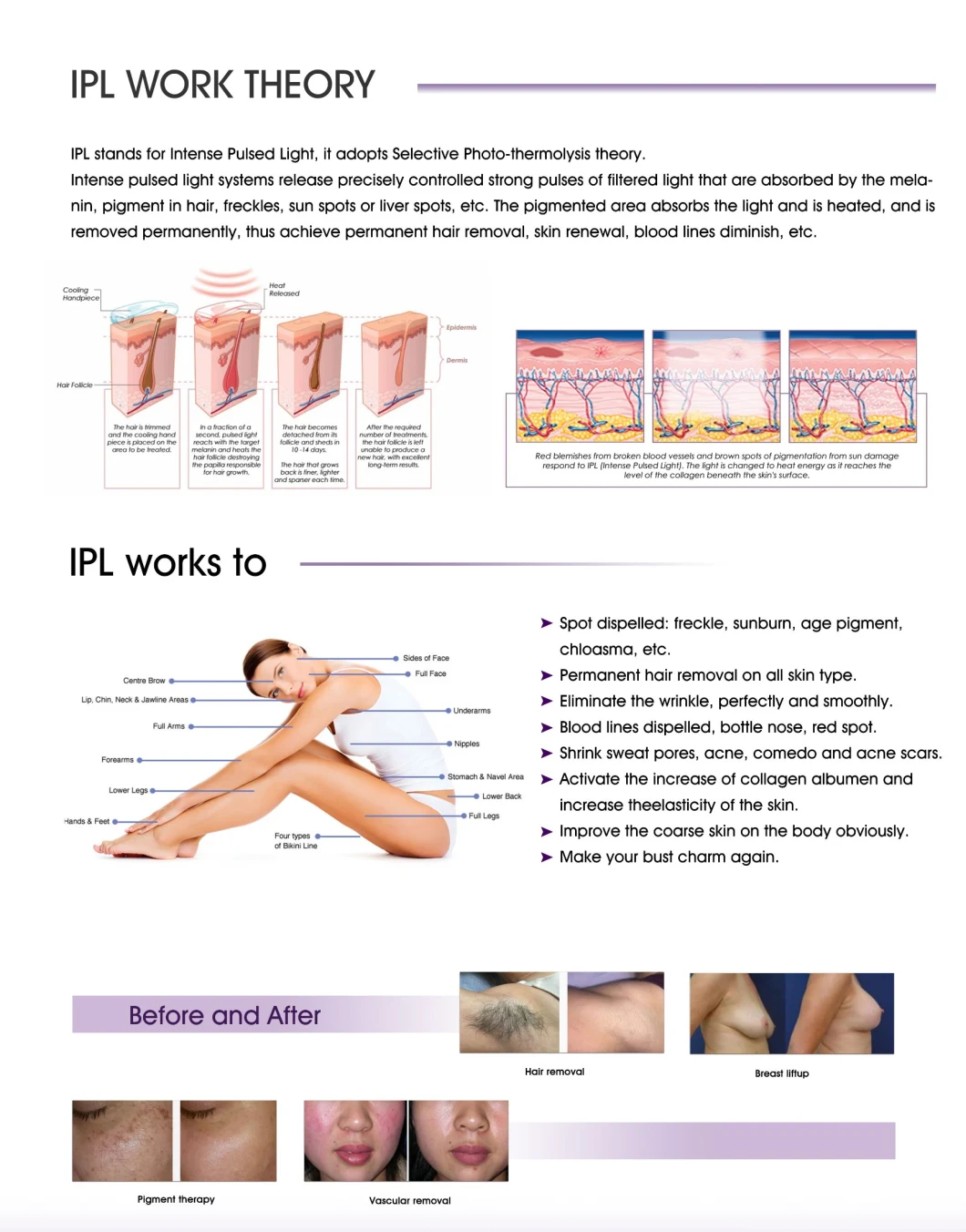 IPL Elight Hair Removal Laser IPL Machine Price with Acne/Pigment/Wrinkle/Vascular Removal Skin Rejuvenation