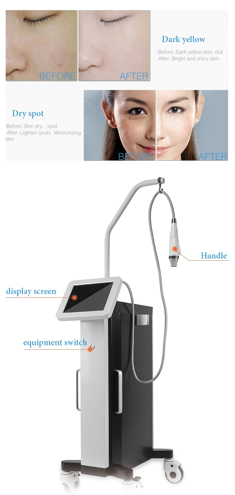 Professional Thermal RF and Fractional RF Home Beauty Device