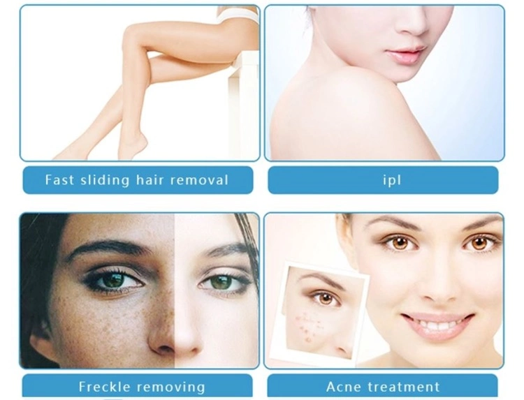 Effective IPL System Beauty Device Shr Permanent Hair Removal Machine