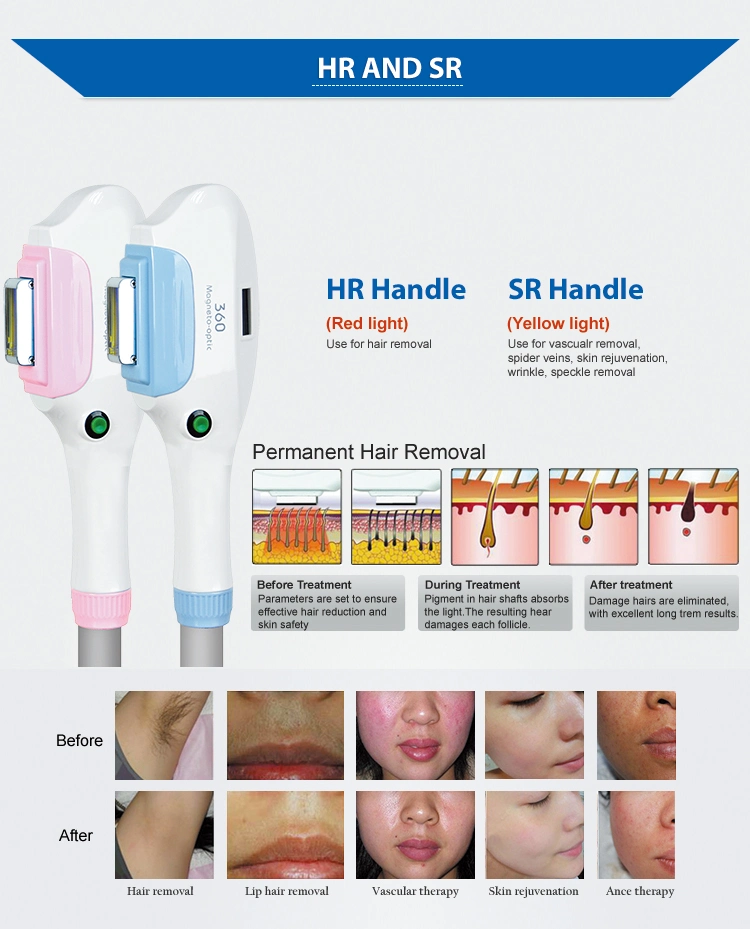 IPL Shr System Dual Hair Removal Handle Skin Rejuvenation Machine