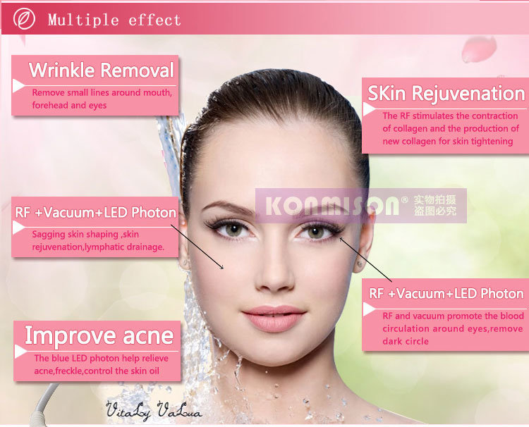 Velashape Salon Use Vacuum RF Photon Skin Tightening Facial Machine