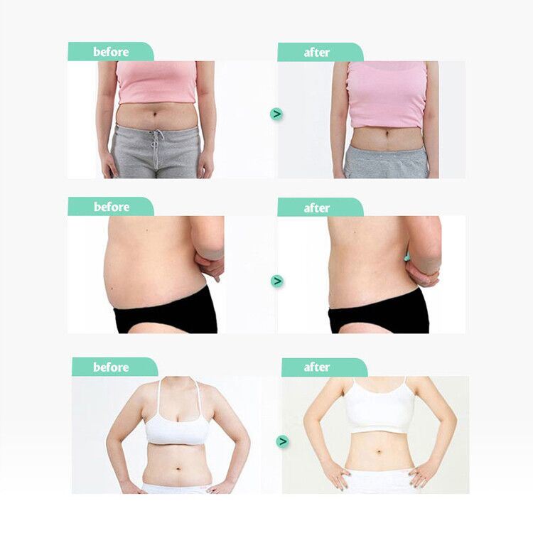 Vacuum Cavitation System Velashape Slimming Machine