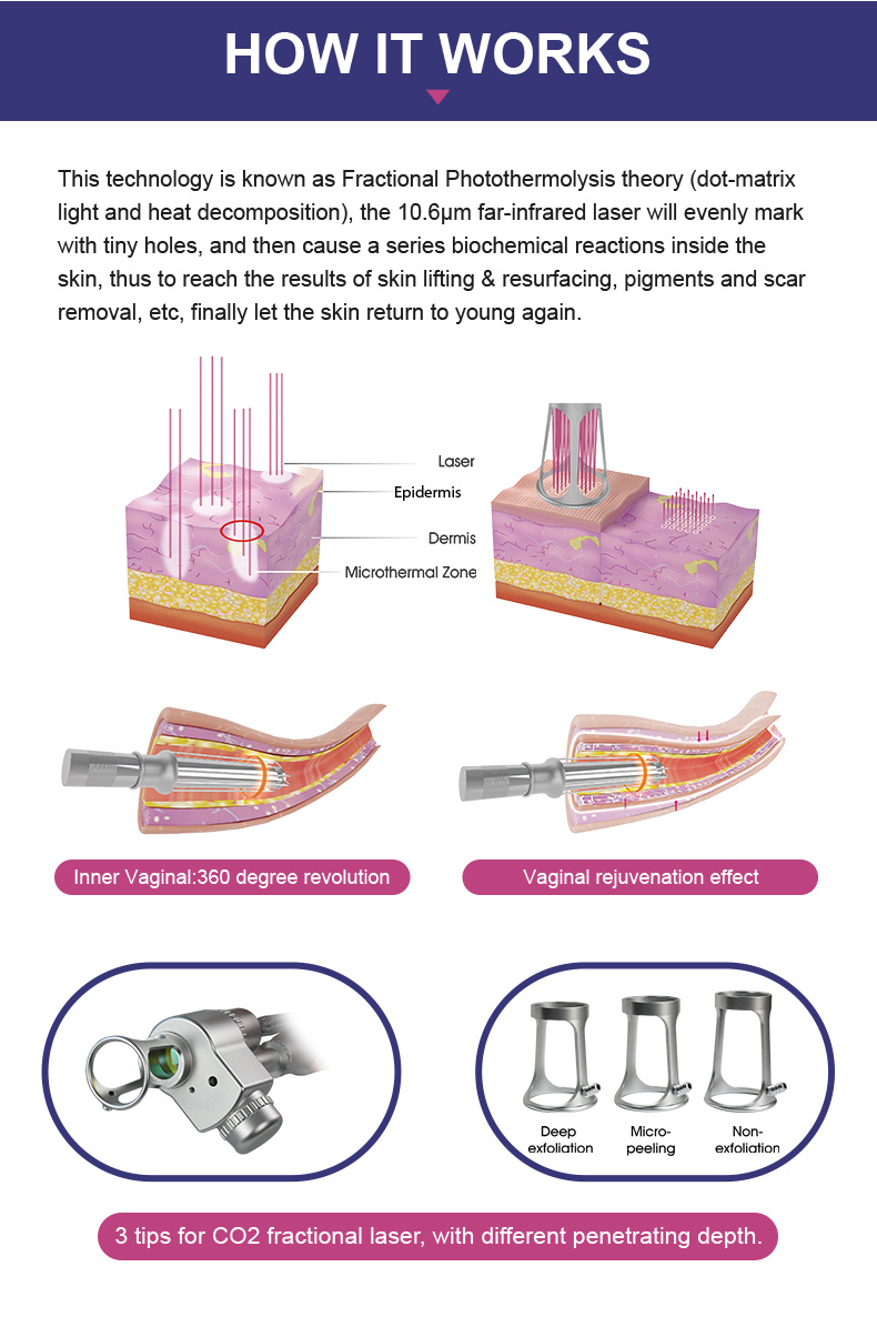 2021 Laser CO2 Fractional Laser Vaginal Tightening Beauty Machine