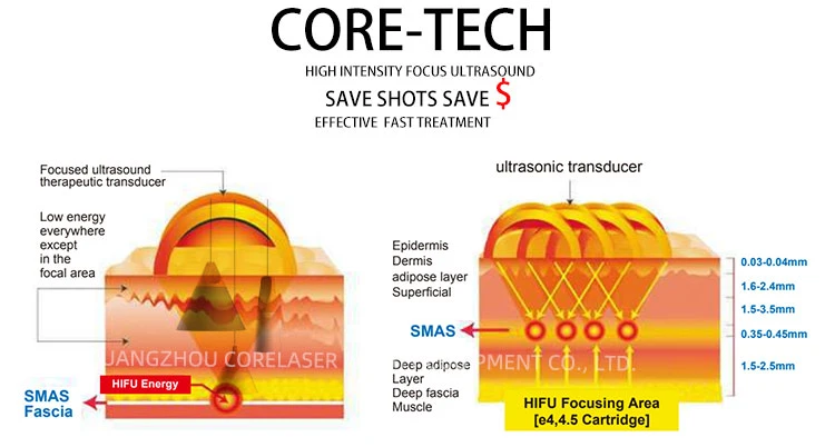 20000 Shots Face Lift Medical Wrinkle Removal 4D Hifu Machine