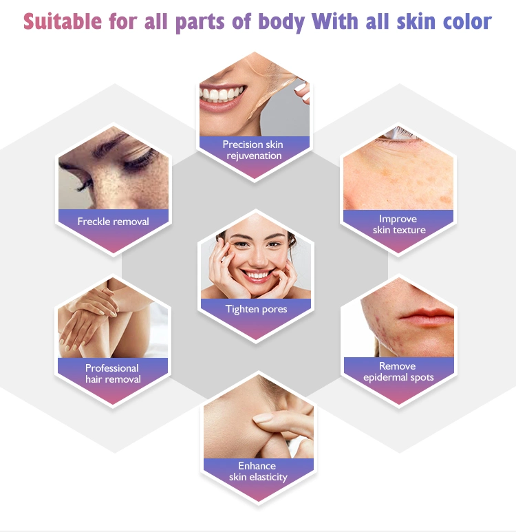 IPL Hair Removal Cost Opt Elight Laser Pore Remover Shr RF Skin Rejuvenation Anti Pigment Freckle