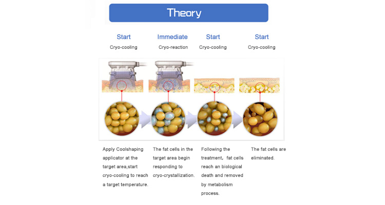 2020 New Cryotherapy Fat Freezing Machine Fat Freeze Therapy Equipment