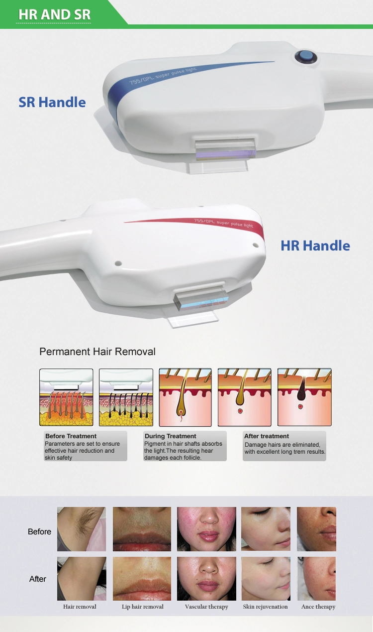 Renlang Permanent Hair Removal Dpl/Opt/Shr IPL Laser Machine