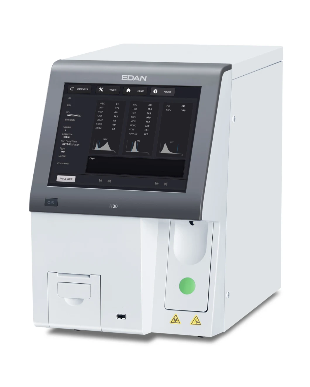 Hematology Analyzer Combo with Chemistry Analyzer Diluent Hematology Analyzer Price Edan H30