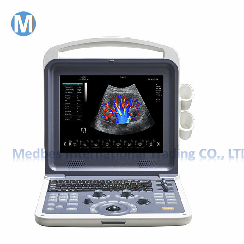 Vascular Cardiac Laptop Portable Color Doppler Ultrasound Scanner