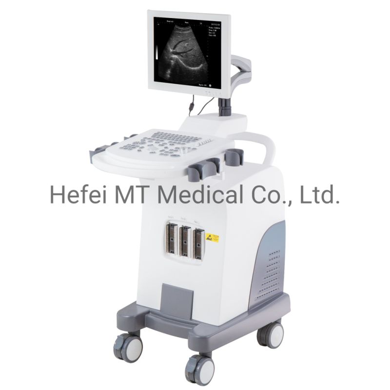 Mt Medical Medical High Accuracy Color Doppler Ultrasound Price Medical Doppler Ultrasound