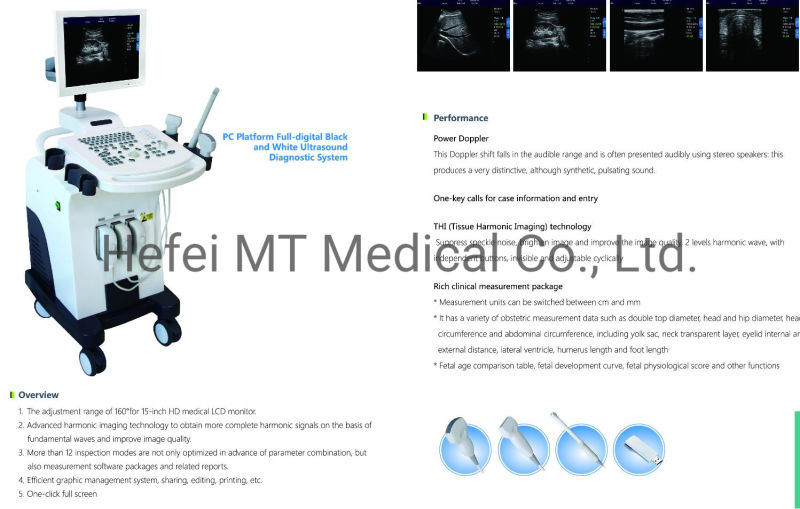 Mt Medical Medical High Accuracy Color Doppler Ultrasound Price Medical Doppler Ultrasound