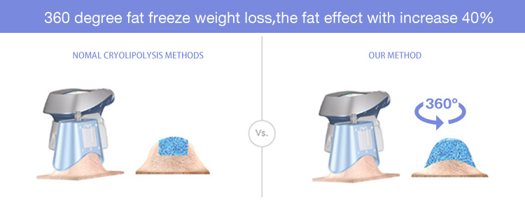 Salon Slimming RF Laser Freezing Lose Weight Cavitation Cryotherapy Beauty Machine