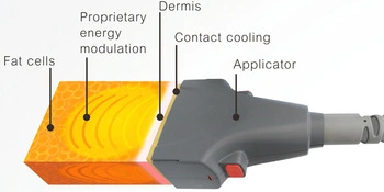 1060nm Diode Laser Body Contouring Body Shaper Slimming Machine
