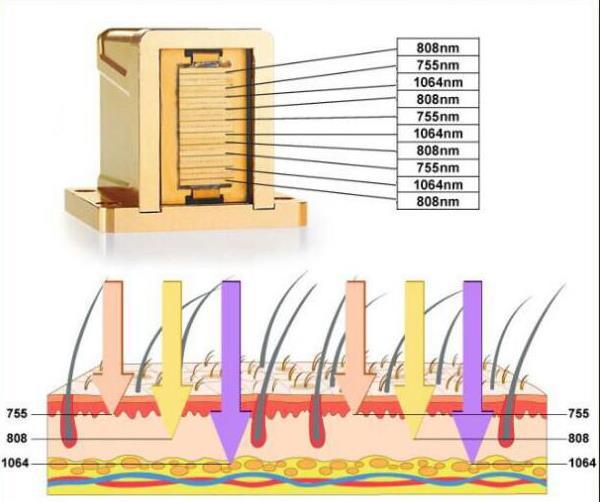 Big Power Laser Diode 808nm / 808 Diode Laser Hair Removal Machine / 808 Laser Price