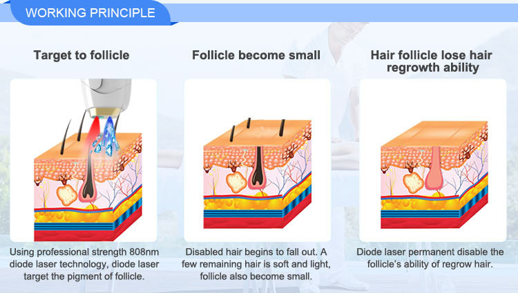 Diode Laser 808nm Hair Removal Skin Rejuvenated Machine