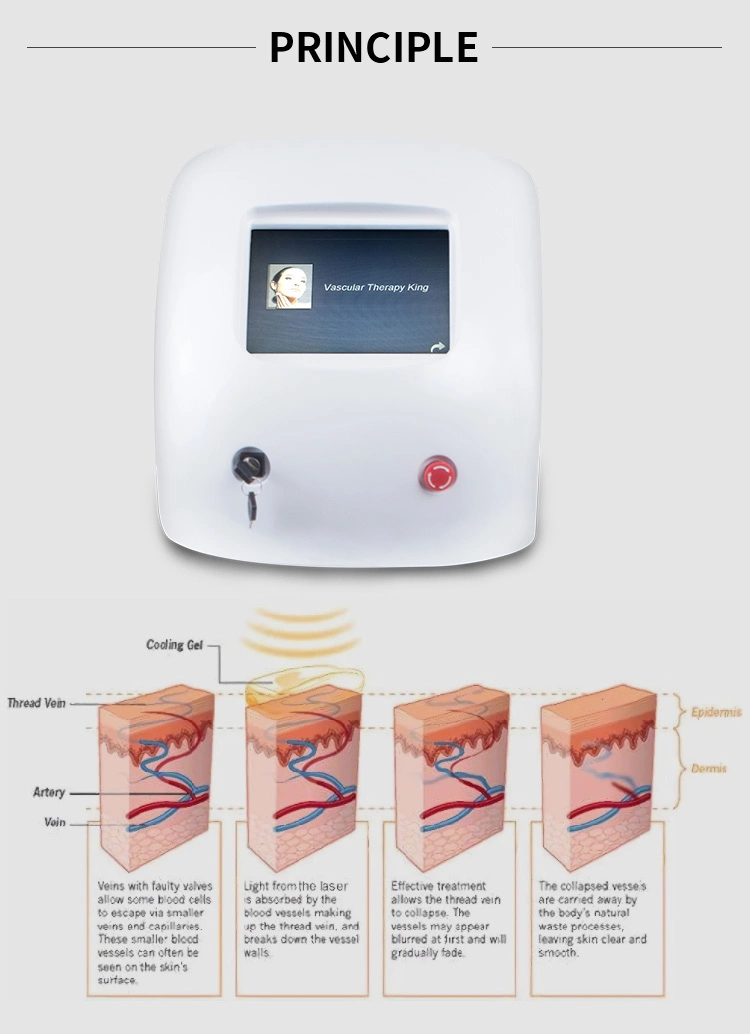 980 Nm Diode Laser Vascular Removal Laser Diode Red Blood Silk Removal Beauty Equipmen