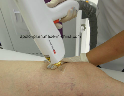 1064 Nm Long Pulse ND YAG Laser Hair Removal Multifunction Beauty Machine
