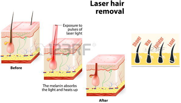 Portable Laser Elight IPL RF Shr Hair Removal Equipment