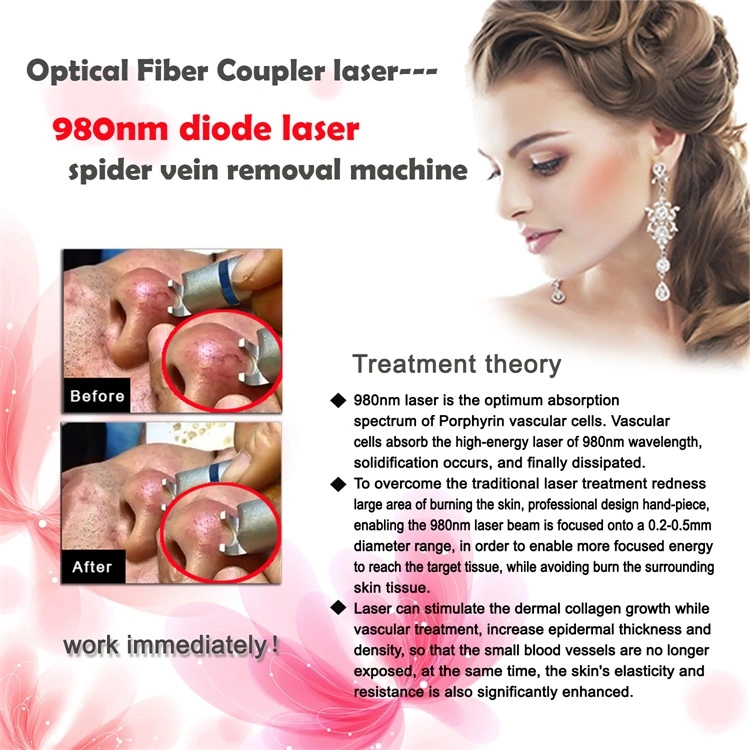 2019 Professional Capillary Removal Machine 980nm Diode Laser Vascular Removal Spider Veins Removal Device