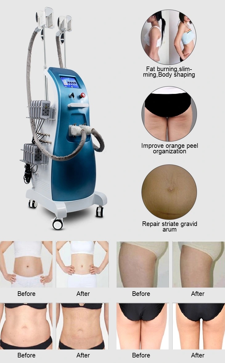 Cryolipolysis Fat Freezing Machine Ultrasonic Cavitation 40K RF Lipo Laser Fat Freeze Slimming Beauty Equipment